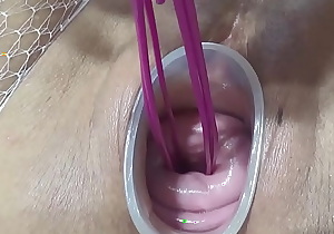 Mature wife fucking cervix and penetration in uterus with knifes